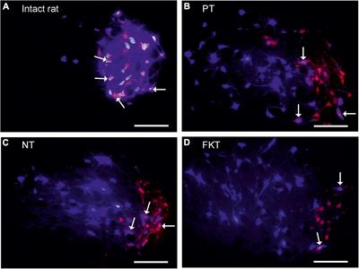 Treatment With Nimodipine or FK506 After Facial Nerve Repair Neither Improves Accuracy of Reinnervation Nor Recovery of Mimetic Function in Rats